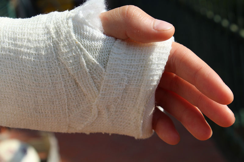 Hand wrapped in orthopedic bandage